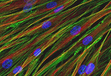 Neonatal human dermal fibroblasts were grown on coverslips, fixed with 4% formaldehyde, and permeabilized with 0.2% Triton X-100. Tubulin was detected with anti–tubulin-a (bovine) antibody (mouse IgG1, monoclonal 236-10501) and visualized using Alexa Fluor® 594 goat anti–mouse IgG. Actin filaments were labeled with Alexa Fluor® 488 phalloidin, and nuclei were stained with Hoechst 33342. Coverslips were mounted on slides using ProLong® Gold antifade reagent. The multiple-exposure image was acquired on a Zeiss LSM 710 confocal microscope at 63x and 16-slice Z-stack maximum intensity projection. Image contributed by Kevin Chambers, Life Technologies.