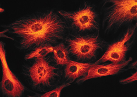 Cultured axolotl sensory neurons stained with our anti–human neuronal protein HuC/HuD antibody (anti-Hu, Cat. no. A21271) and detected using the red-orange–fluorescent Alexa Fluor® 546 goat anti–mouse IgG antibody (Cat. no. A11003). Actin was labeled using green-fluorescent Alexa Fluor® 488 phalloidin (Cat. no. A12379) and nuclei were stained with blue-fluorescent Hoechst 33342 (Cat. no. H1399, H3570, H21492). The image was contributed by Josh Gross and Linda Barlow, University of Denver, Denver, Colorado.
