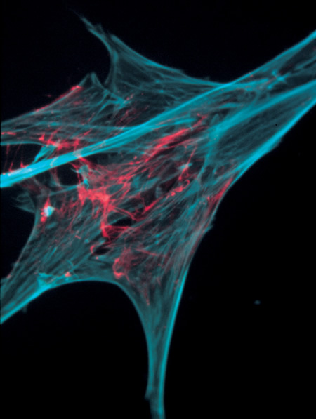 Chick embryo fibroblasts injected with the Alexa Fluor® 568 conjugate of actin from rabbit muscle (Cat. no. A12374). The cells were then fixed and permeabilized, and the filamentous actin was stained with coumarin phallacidin (Cat. no. C606). The double-exposure image was acquired using longpass filter sets appropriate for rhodamine and DAPI. Image contributed by Heiti Paves, Laboratory of Molecular Genetics, National Institute of Chemical Physics and Biophysics, Estonia.