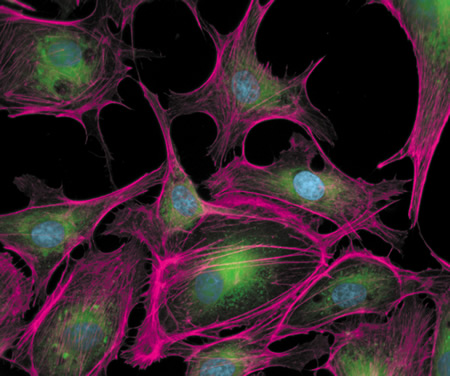 Subcellular structures in fixed and permeabilized bovine pulmonary artery endothelial cells visualized with several fluorescent dyes. Filamentous actin (F-actin) was identified with Alexa Fluor® 633 phalloidin (Cat. no. A22284), which is pseudocolored magenta. Lipophilic regions of the cell, including intracellular membranes, were stained with green-fluorescent DiOC6(3) (Cat. no. D273). Finally, nuclei were counterstained with blue-fluorescent DAPI (Cat. no. D1306, D3571, D21490). The image was acquired using filters appropriate for fluorescein and DAPI and a special filter (courtesy of Omega Optical) for the Alexa Fluor® 633 dye, consisting of a narrow band exciter (Cat. no. 630DF10), dichroic (Cat. no. 640DRLP) and emitter (Cat. no. 660DF10).