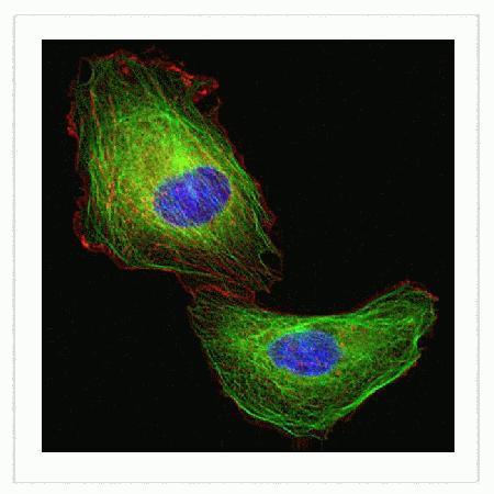 U-2 OS cells were transduced with and CellLight™ MAP4-GFP (Cat. No. C10598) and Cellular Lights™ Actin-RFP (Cat. No. C10127). The next day, cells were treated with cytochalasin D and nuclei stained with Hoechst 33342 (Cat. No. H24192) and live-cell imaging was performed using a 40X objective on a DeltaVision® Core microscope with standard DAPI/FITC/TRITC filter sets. Note the disruption of actin filaments (red) whereas despite the change in cell shape microtubules are still clearly visible (green).