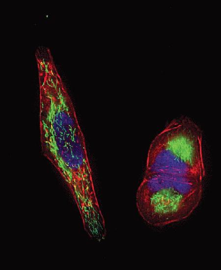 HeLa cells were transduced with CellLight™ Mitochondria-GFP (Cat. No. C10600) and CellLight™ Talin-RFP (Cat. no. C10612). The following day, cells were stained with Hoechst 33342 (Cat. No. H24192) and imaging was performed on live cells using a DeltaVision® Core microscope and standard DAPI/FITC/TRITC filter sets.