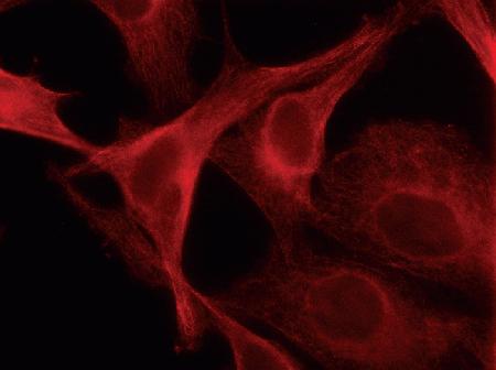 HeLa cells transduced with CellLight™ Tubulin-RFP (Cat. no. C10614). The following day, live-cell imaging was performed using a DeltaVision® Core microscope and standard TRITC filter sets.