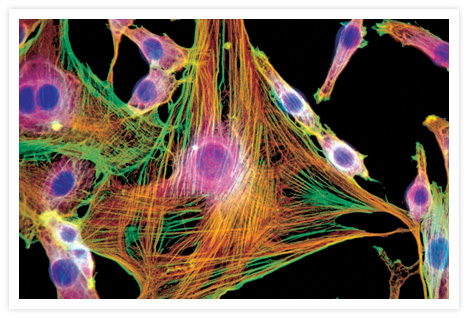 Photomicrograph of mouse fibroblasts that have been formaldehyde-fixed, acetone-permeabilized and triple-stained with the F-actin–specific probe BODIPY® FL phallacidin (Cat. no. B607), with mouse monoclonal anti–ß-tubulin antibody in conjunction with Texas Red® goat anti–mouse IgG antibody (Cat. no. T862) and with DAPI (Cat. no. D1306, D3571, D21490). The image was obtained by taking multiple exposures through bandpass optical filter sets appropriate for fluorescein, Texas Red® dye and DAPI using a 100X Plan Apochromat objective.