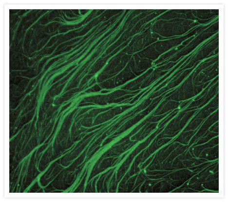 Microtubules formed from a solution of Oregon Green® 514 tubulin (T12391) in a polymerization buffer consisting of 0.5 mg GTP in 1 mL of 1% DMSO, 1 mM MgCl<sub>2</sub>, 1 mM EDTA and 80 mM PIPES at pH 6.8. This solution was subsequently diluted 1:4, pipetted onto a glass slide and photographed using an epifluorescence microscope equipped with a longpass filter appropriate for fluorescein.