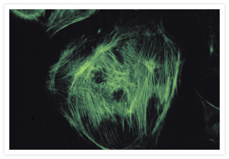 Bovine pulmonary artery endothelial cells that were fixed with acetone, treated with Triton X-100, incubated with biotin-XX phalloidin (Cat. no. B7474) and then developed for visualization with the ELF® Cytological Labeling Kit (Cat. no. E6603). Actin stress fibers were photographed through the ELF® filter set.