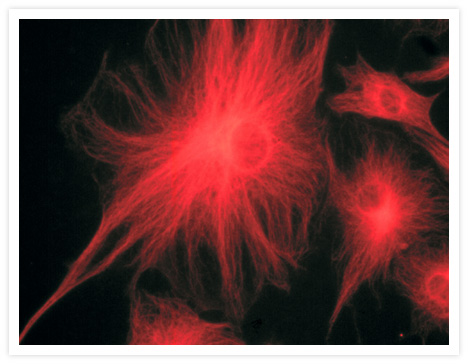 A bovine pulmonary artery endothelial cell labeled with mouse monoclonal anti–a-tubulin antibody (Cat. No. A11126) in combination with Alexa Fluor® 568 goat anti–mouse IgG (Cat. No. A11004) to stain microtubules. The image was acquired using a bandpass filter set appropriate for X-rhodamine.
