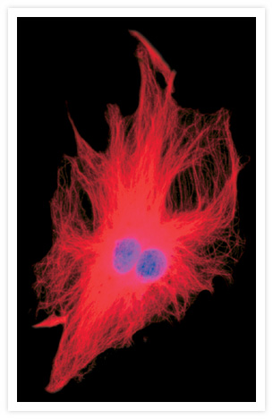 Microtubules of a fixed bovine pulmonary artery endothelial cell labeled with mouse monoclonal anti–a-tubulin antibody (Cat. no. A11126), and detected with Rhodamine Red™-X goat anti–mouse IgG (Cat. no. R6393). The nucleus was counterstained with DAPI (Cat. no. D1306, D3571, D21490). The multiple-exposure image was acquired using bandpass filters appropriate for Texas Red® dye and DAPI.