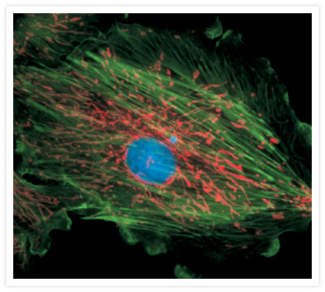 FluoCells® prepared slide #1 (Cat. no. F14780) showing bovine pulmonary artery endothelial cells incubated with MitoTracker® Red CMXRos (Cat. no. M7512) to label the mitochondria. After fixation and permeabilization, the cells were stained with BODIPY® FL phallacidin (Cat. no. B607) to label the F-actin filaments and finally counterstained with DAPI (Cat. no. D1306, D3571) to label the nucleus. The multiple-exposure image was acquired using bandpass filters appropriate for Texas Red® dye, fluorescein and DAPI.