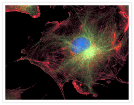 FluoCells® prepared slide #2 (Cat. no. F14781) showing bovine pulmonary artery endothelial cells probed with anti–bovine a-tubulin mouse monoclonal 236-10501 (Cat. no. A11126) and visualized with BODIPY® FL goat anti–mouse IgG (Cat. no. B2752). The actin filaments were then labeled with Texas Red®-X phalloidin (Cat. no. T7471) and the nuclei were counterstained with DAPI (Cat. no. D1306, D3571). The multiple-exposure image was acquired using bandpass filters appropriate for Texas Red® dye, fluorescein and DAPI.