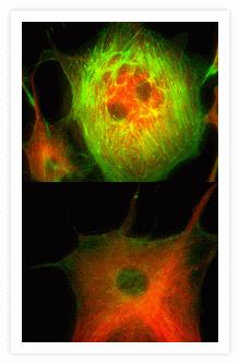 Photostability comparison of Alexa Fluor® 488 phalloidin (top panel, Cat. no. A12379) and fluorescein phalloidin (bottom panel, Cat. no. F432). Bovine pulmonary artery endothelial cells labeled with 5 units/mL of Alexa Fluor® 488 phalloidin or fluorescein phalloidin, and 10 µg/mL of Alexa Fluor® 546 goat anti–mouse IgG (red-fluorescent tubulin staining, Cat. no. A11003). Images were acquired every three seconds for a total of 50 seconds using a Quantix camera (Photometrics).