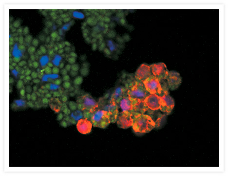 Cultured axolotl sensory neurons stained with our anti–human neuronal protein HuC/HuD antibody (anti-Hu, Cat. no. A21271) and detected using the red-orange–fluorescent Alexa Fluor® 546 goat anti–mouse IgG antibody (Cat. no. A11003). Actin was labeled using green-fluorescent Alexa Fluor® 488 phalloidin (Cat. no. A12379) and nuclei were stained with blue-fluorescent Hoechst 33342 (Cat. no. H1399, H3570, H21492). The image was contributed by Josh Gross and Linda Barlow, University of Denver, Denver, Colorado.
