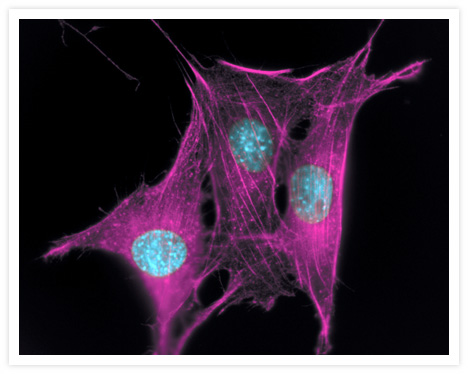 Actin filaments of fixed bovine pulmonary artery endothelial cells (Cat. no. BPAEC) labeled with Alexa Fluor® 647 phalloidin (Cat. no. A22287). Nuclei were stained with DAPI (Cat. no. D1306, D3571, D21490).
