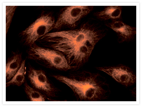 Microtubules of fixed bovine pulmonary artery endothelial cells (BPAEC) labeled with mouse monoclonal anti–a-tubulin antibody (Cat. no. A11126), followed by fluorescein goat anti–mouse IgG (Cat. no. F2761). The orange-fluorescent signal was produced using R-phycoerythrin–labeled anti–fluorescein/Oregon Green® antibody (Cat. no. A21250).