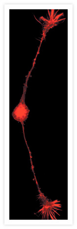 A fixed and permeabilized rat embryonic sensory neuron was stained with the filamentous actin (F-actin) stain, rhodamine phalloidin (Cat. no. R415). The image was acquired using filters appropriate for TRITC. Image contributed by Heiti Paves, Laboratory of Molecular Genetics, National Institute of Chemical Physics and Biophysics, Estonia.