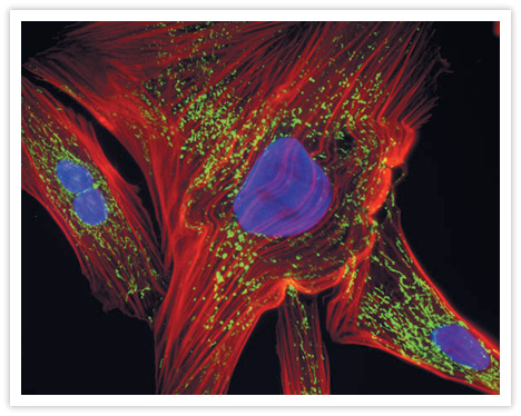 UV-irradiated muntjac skin fibroblasts showing mitochondrial damage. Fixed, permeabilized cells were stained with Texas Red®-X phalloidin (Cat. no. T7471) to visualize F-actin in the cytoskeleton. Endogenous biotin in the mitochondria was detected with Alexa Fluor® 488 streptavidin (Cat. no. S11223). Nuclei were counterstained with DAPI (Cat. no. D1306, D3571, D21490).