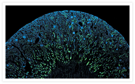 Mouse kidney cryosection. The lumenal surface of some distal tubules in the cortex was labeled with the Alexa Fluor® 488 conjugate of lectin PHA-L from <i>Phaseolus vulgaris</i> (red kidney bean) (Cat. no. L11270, green). Proximal tubules and Bowman's capsules were stained with Alexa Fluor® 568 phalloidin (Cat. no. A12380, pseudocolored blue).