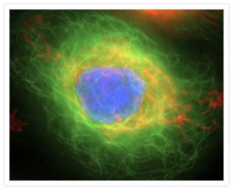 Live bovine pulmonary artery endothelial cell labeled with TubulinTracker™ Green reagent (T34075). Mitochondria were stained with MitoTracker® Red CMXRos (M7512), and the nucleus was stained with Hoechst 33342 (H1399, H3570, H21492).