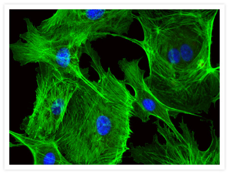 Actin filaments in bovine pulmonary artery endothelial cells were visualized with Alexa Fluor® 488 phalloidin (Cat. no. A12379). Nuclei were stained with blue-fluorescent DAPI (Cat. no. D1306, D3571, D21490).