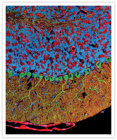 A mouse cerebellum section visualized using a fluorescent Qdot® nanocrystal conjugate. IP3 receptors were labeled with a rabbit anti-IP3 antibody and visualized using green-fluorescent Qdot® 525 goat F(ab')<sub>2</sub> anti–rabbit IgG (Cat. no. Q11441MP). Actin was labeled with red-fluorescent rhodamine phalloidin (Cat. no. R415). Nuclei were stained with blue-fluorescent DAPI (Cat. no. D1306, D3571, D21490). Image contributed by Thomas Deerinck and Mark Ellisman, The National Center for Microscopy and Imaging Research, San Diego, CA.